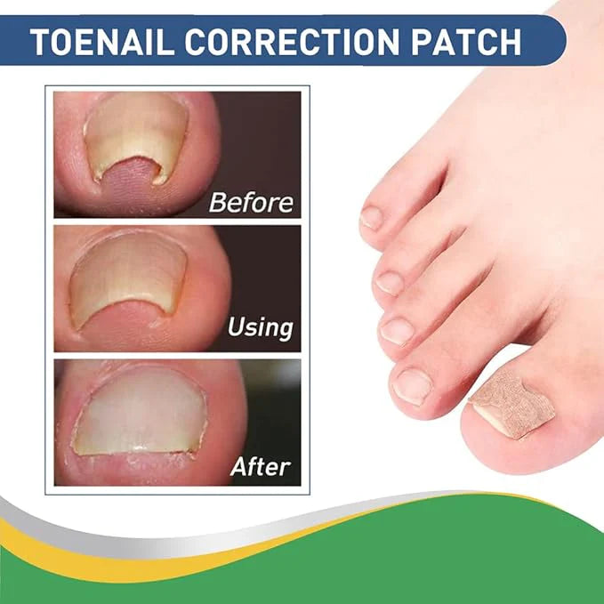 Hanel - Pain Relief Patch|لاصق هانيل لتخفيف الألم